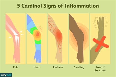 inflamed definition.